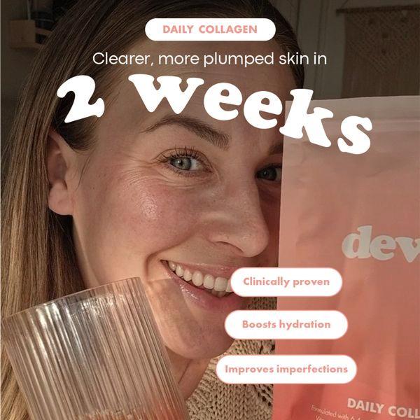 A close-up selfie of a woman holding a pouch of daily collagen powder, utilizing overlaid benefit bubbles to validate product efficacy.
